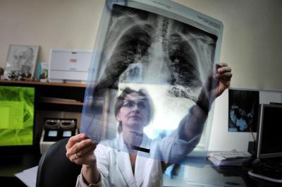 Орловцы смогут бесплатно проверить здоровье легких